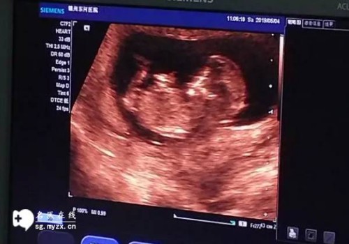 胚胎着床初期的小症状，疲倦、嗜睡你躺枪了吗？